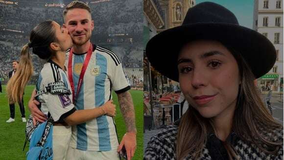 Camila Mayan mostró el retoque que se hizo en su cola tras la separación de Alexis Mac Allister: “Duele un poco”