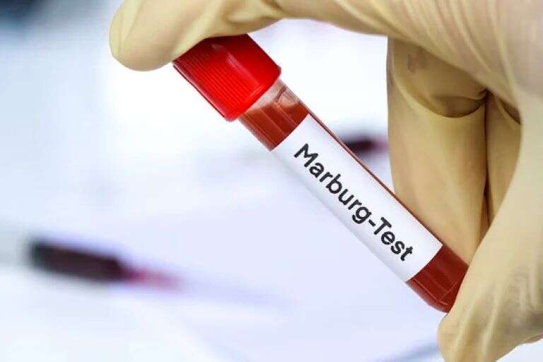 Tanzania: Murieron ocho personas por posible brote de la enfermedad del virus de Marburgo