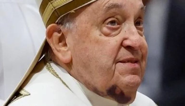 Vaticano: El papa Francisco padece neumonía bilateral y su estado es “complejo”